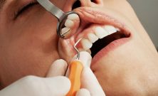 Allt du behöver veta om tandläkare Sollentuna