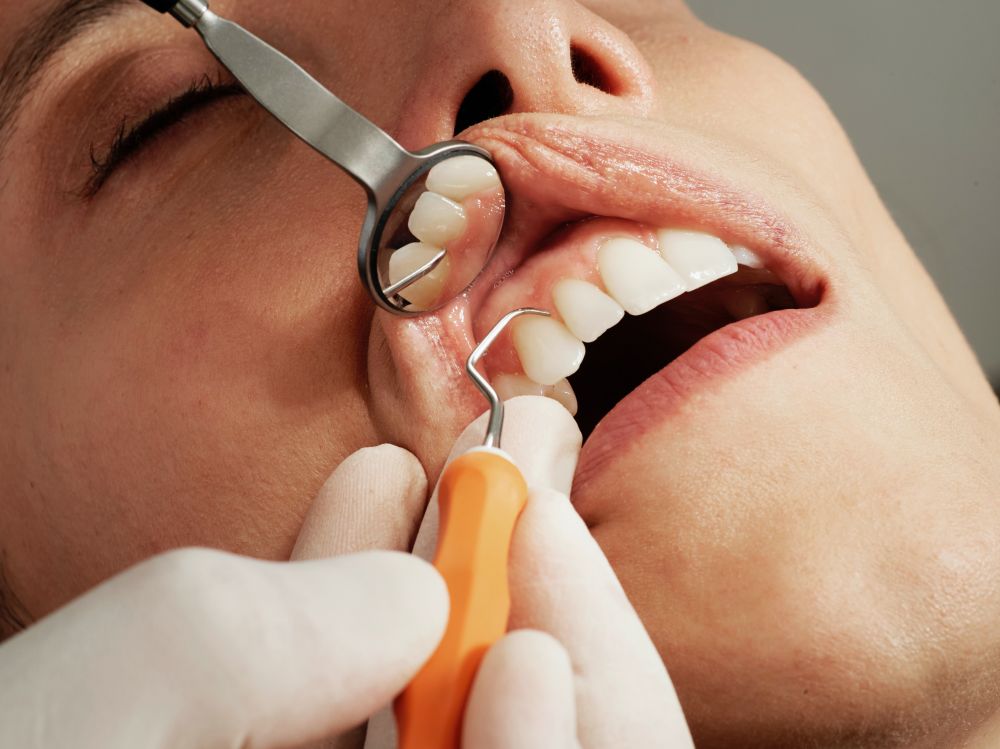 Allt du behöver veta om tandläkare Sollentuna