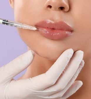 Fillers för läppar: En väg till fylligare och naturliga resultat