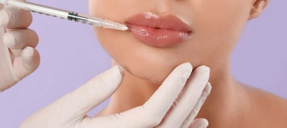 Fillers för läppar: En väg till fylligare och naturliga resultat