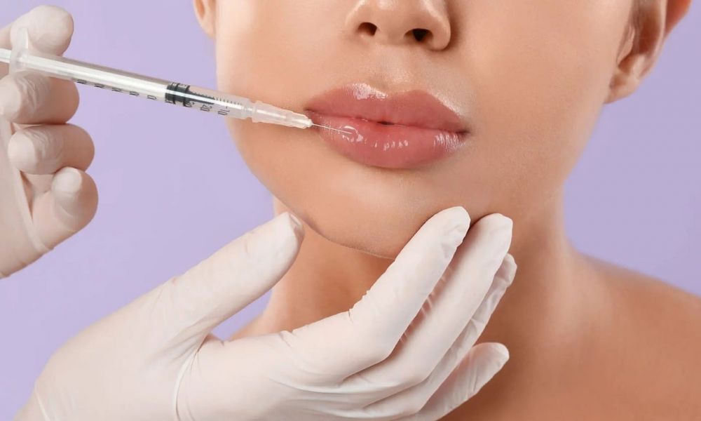 Fillers för läppar: En väg till fylligare och naturliga resultat